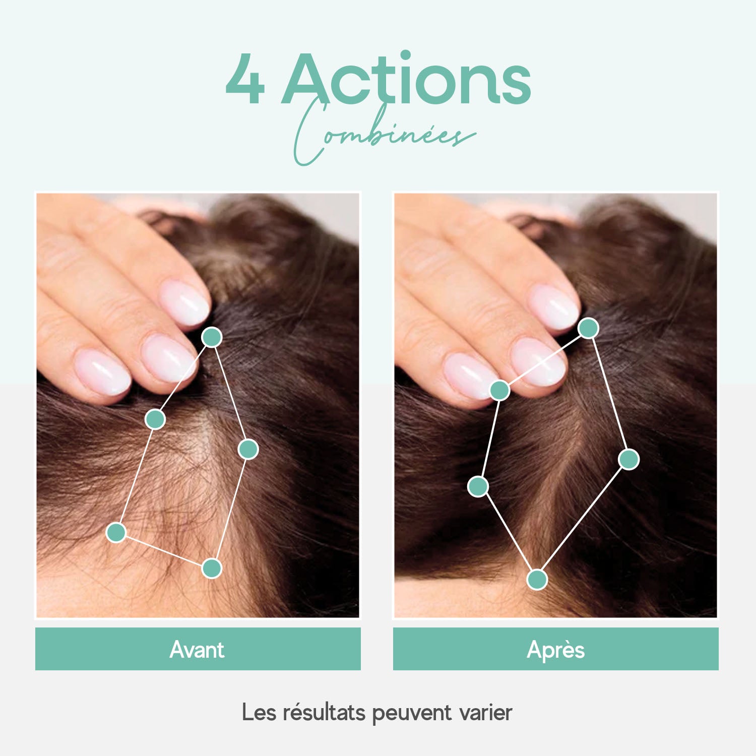 Pousse et vitalité des cheveux